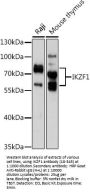 IKZF1 Antibody