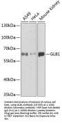 GLB1 Antibody