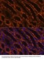 LAMC2 Antibody
