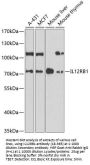 IL12RB1 Antibody