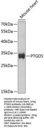 PTGDS Antibody