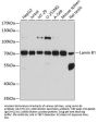 Lamin B1 Antibody, KO Validated