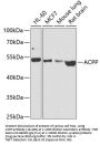 ACPP Antibody