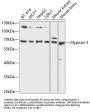 Glypican 3 Antibody
