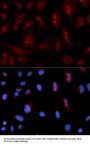 PLCB1 Antibody