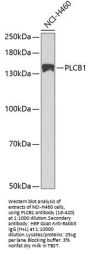 PLCB1 Antibody