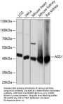 ASS1 Antibody