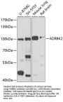 ADRBK2 Antibody