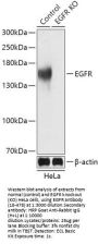 EGFR Antibody
