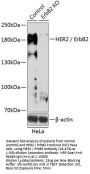 HER2 / ErbB2 Antibody, KO Validated