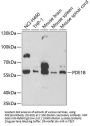 PDE1B Antibody
