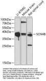 SCN4B Antibody
