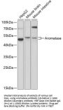 Aromatase Antibody