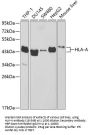 HLA-A Antibody