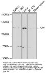 OGT Antibody