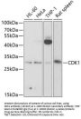 CDK1 Antibody