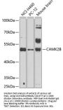 CAMK2B Antibody