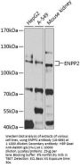 ENPP2 Antibody
