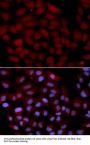 TNK2 Antibody