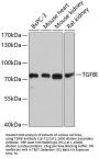 TGFBI Antibody