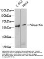 Vimentin Antibody