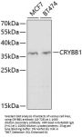 CRYBB1 Antibody