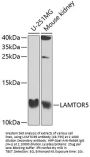 LAMTOR5 Antibody