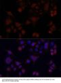 MAPRE1 Antibody