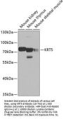 KRT5 Antibody