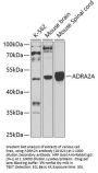 ADRA2A Antibody