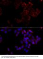 Bcl2 Antibody