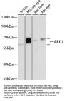 GRK1 Antibody