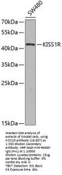 KISS1R Antibody