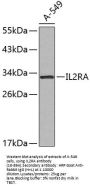 IL2RA Antibody