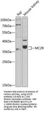 MC2R Antibody