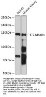 E-Cadherin Antibody