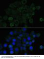 E-Cadherin Antibody