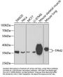 TPM2 Antibody