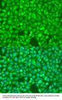 NFkB p100 / p52 Antibody