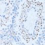 NFkB p100 / p52 Antibody