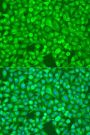 NFkB p100 / p52 Antibody