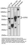 SSTR2 Antibody