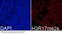 Symmetric DiMethyl-Histone H3-R17 pAb