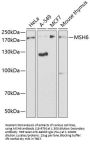 MSH6 Antibody