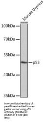 p53 Antibody