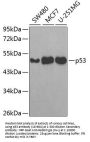 p53 Antibody