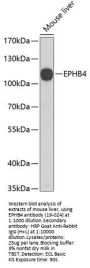 EPHB4 Antibody