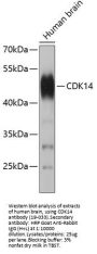 CDK14 Antibody