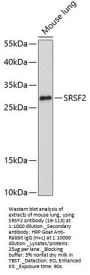SRSF2 Antibody