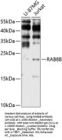 RAB8B Antibody